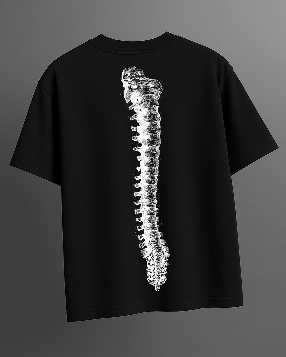 SKELETON SCAN